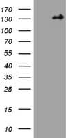 Hamartin / TSC1 Antibody (clone OTI5A8)