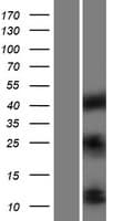 Human IGF1 Protein (Over-Expression Lysate Myc-DDK (Flag))