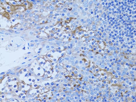 HADH Antibody