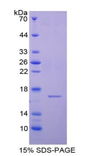 Human CST6 / Cystatin E/M Protein (Recombinant His-T7)