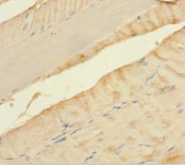 MLXIP / MONDOA Antibody (aa1-217)
