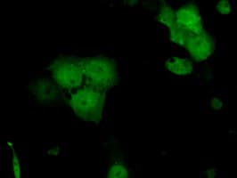 SRR / Serine Racemase Antibody (clone OTI7E8, Carrier-free)