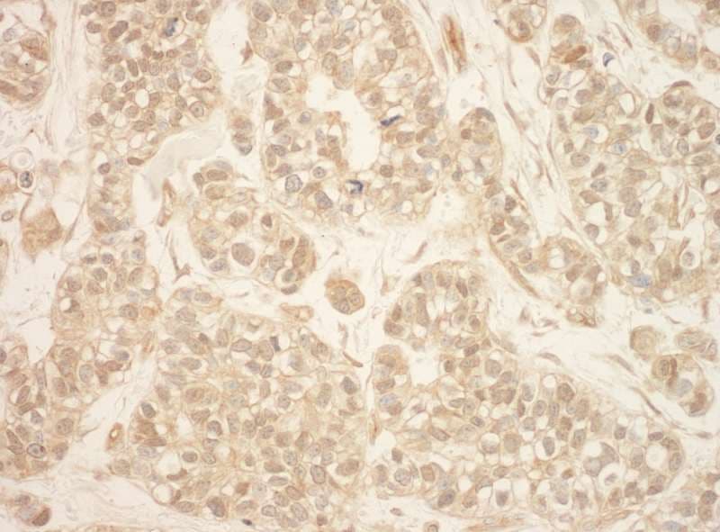 RPS6KA3 / RSK2 Antibody (aa1-50)