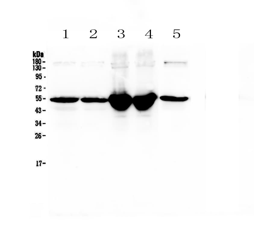 Polyclonal Rabbit anti-Mouse GC / Vitamin D-Binding Protein Antibody (WB)