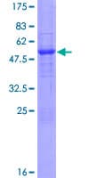 Human RPP40 / Ribonuclease P Protein (Recombinant GST)