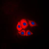 Polyclonal Rabbit anti-Human BCAR1 / p130Cas Antibody (phospho-Tyr249, IF, WB)