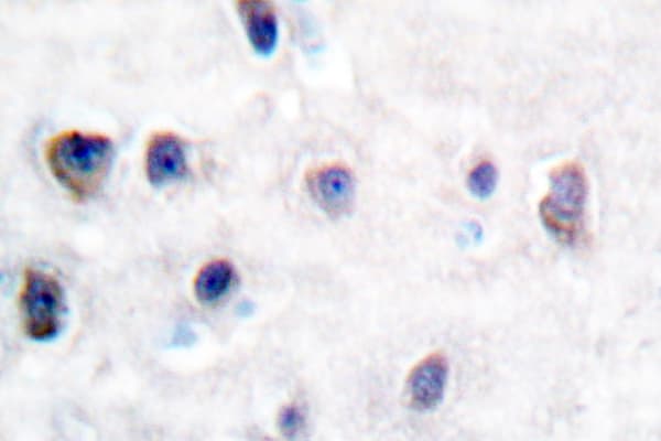 APP / Beta Amyloid Precursor Antibody (Glu737/662)