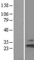 TIM23 Protein (Over-Expression Lysate Myc-DDK (Flag))