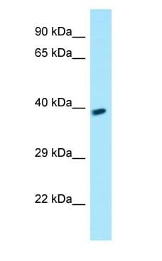Polyclonal Rabbit anti-Human GPR78 Antibody (aa277-326, WB)
