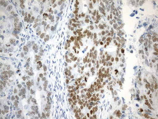 EZH2 Antibody (aa182-431, clone UMAB264)