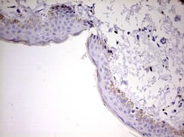 KLK8 / Kallikrein 8 Antibody (aa33-260, clone OTI11F7, Carrier-free)