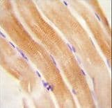 Polyclonal Rabbit anti-Human FNIP2 Antibody (aa776-804, IHC, WB)