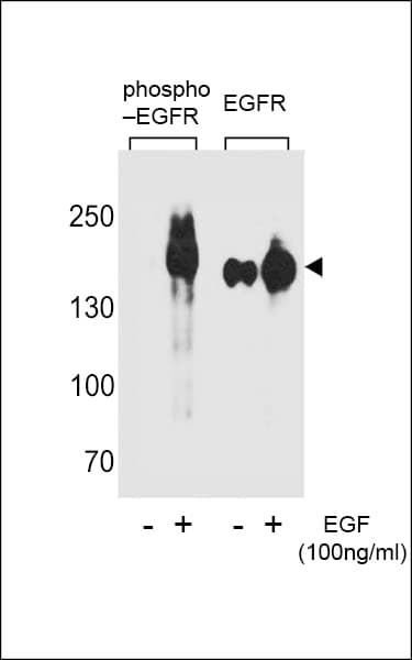 Polyclonal Rabbit anti-Human EGFR Antibody (phospho-Tyr1172, WB)