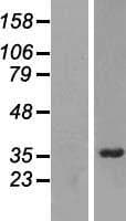CGI-96 / RRP7A Protein (Over-Expression Lysate Myc-DDK (Flag))