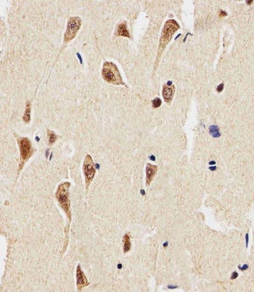 Polyclonal Rabbit anti-Human SLC29A1 / ENT1 Antibody (aa402-431, IHC, WB)