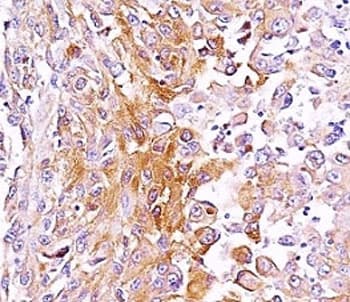 PMEL / SILV / gp100 Antibody (clone SPM286)