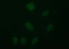 Monoclonal Mouse anti-Human TUBB2B / Tubulin Beta 2B Antibody (clone OTI6D11, IF, WB)