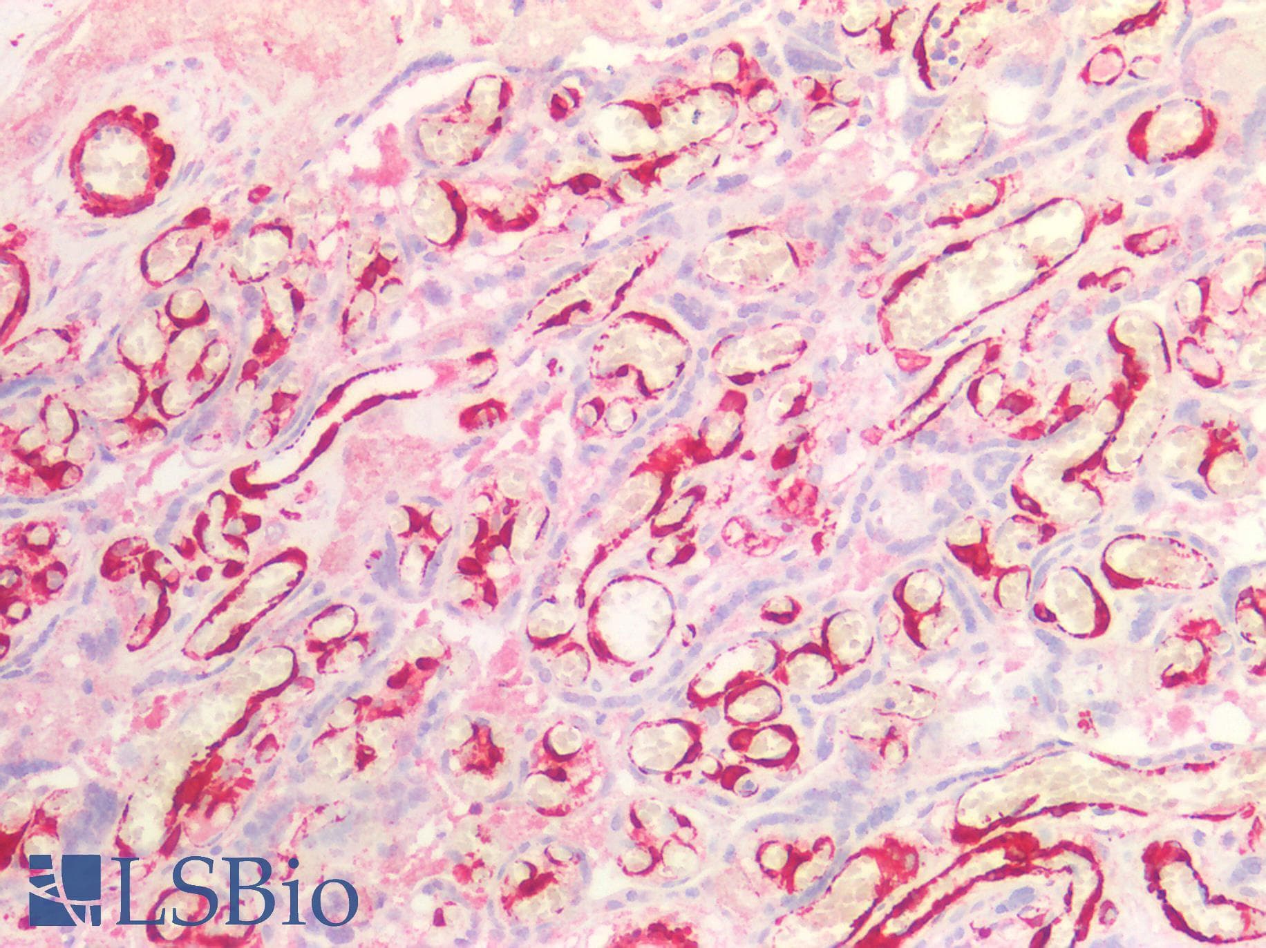 IHC-plus™ SMMHC / MYH11 Antibody