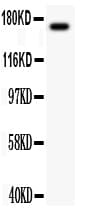 Polyclonal Rabbit anti-Human MAP3K1 / MEKK1 Antibody (aa1418-1432, IHC, WB)