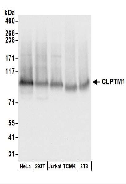 Polyclonal Rabbit anti-Human CLPTM1 Antibody (aa619-669, WB)