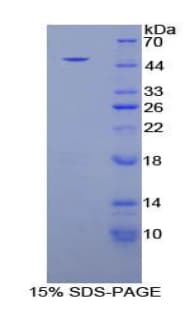 Rat NR3C1/Glucocorticoid Receptor Protein (Recombinant His-GST)
