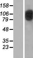 CIZ1 Protein (Over-Expression Lysate Myc-DDK (Flag))