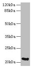 Polyclonal Rabbit anti-Human SPCS3 Antibody (IHC)