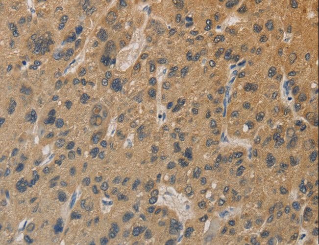 DDX19B Antibody