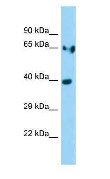 Polyclonal Rabbit anti-Rat LDHA / LDH1 Antibody (aa91-140, WB)