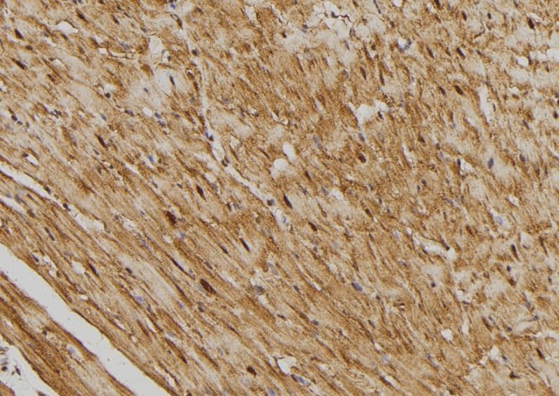 SSH3 Antibody