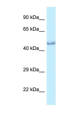 PRMT6 Antibody (C-Terminus)