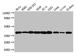 Polyclonal Rabbit anti-Human ANXA2 / Annexin A2 Antibody (aa2-339, IHC, WB)