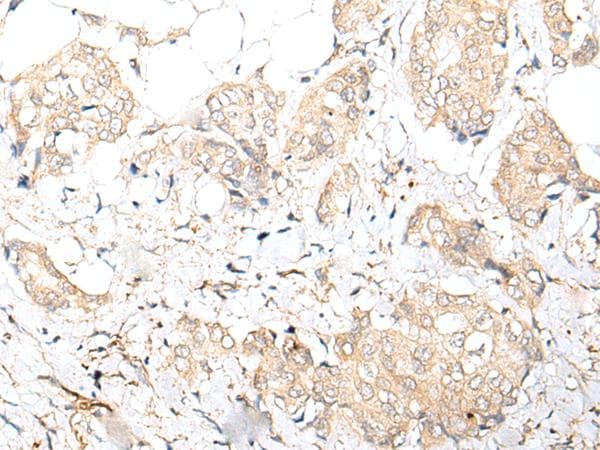 FOXO4 / AFX1 Antibody