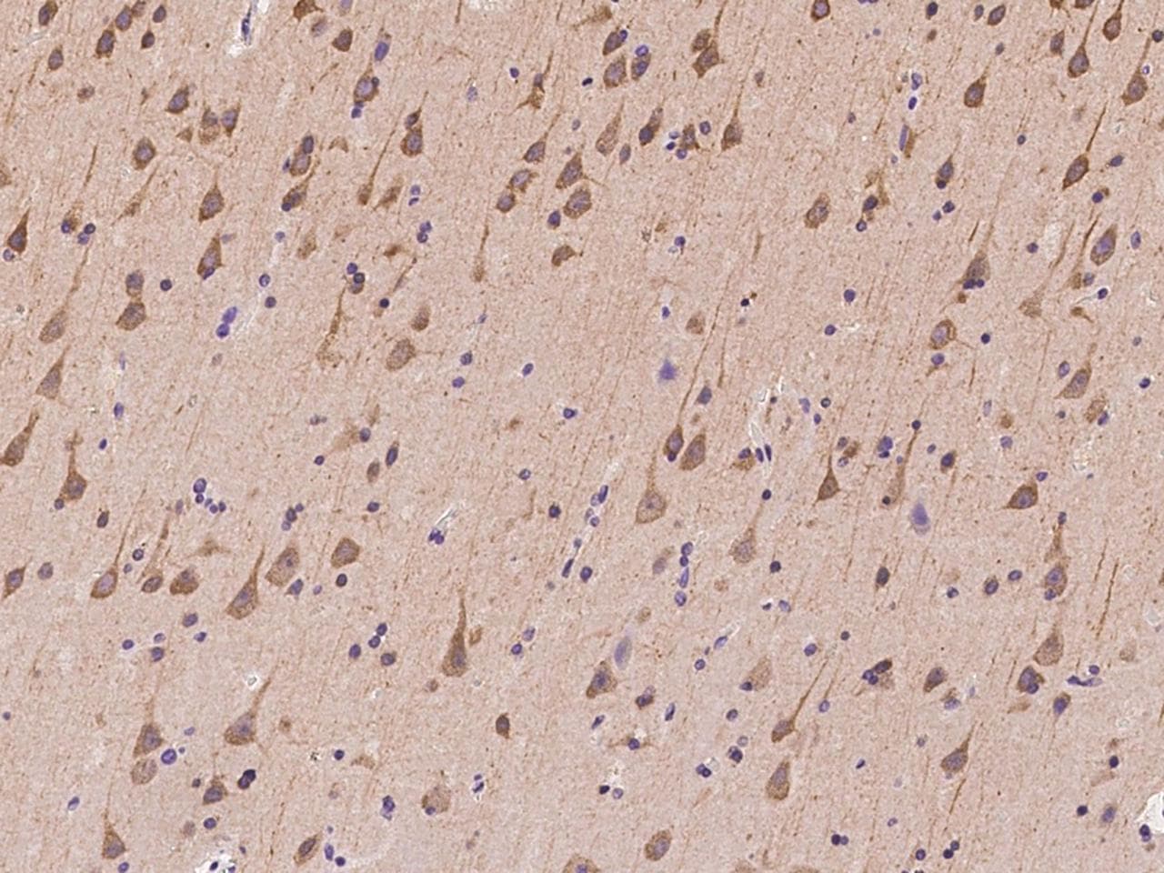 Polyclonal Rabbit anti-Human ZNF415 Antibody (IHC)
