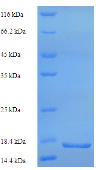 Human PLA2R / PLA2R1 Protein (Recombinant His)