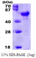 Human PTX3 / Pentraxin 3 Protein (Recombinant His)