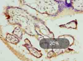 Polyclonal Rabbit anti-Human DHRS3 / SDR1 Antibody (IHC, WB)