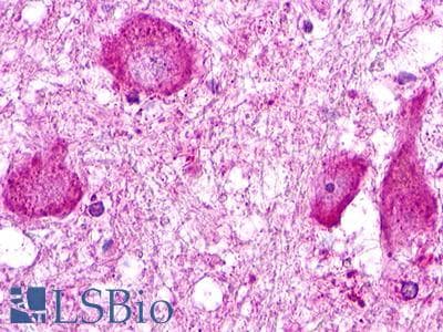 PathPlus™ ACKR2 / CCR10 / D6 Antibody (Internal)