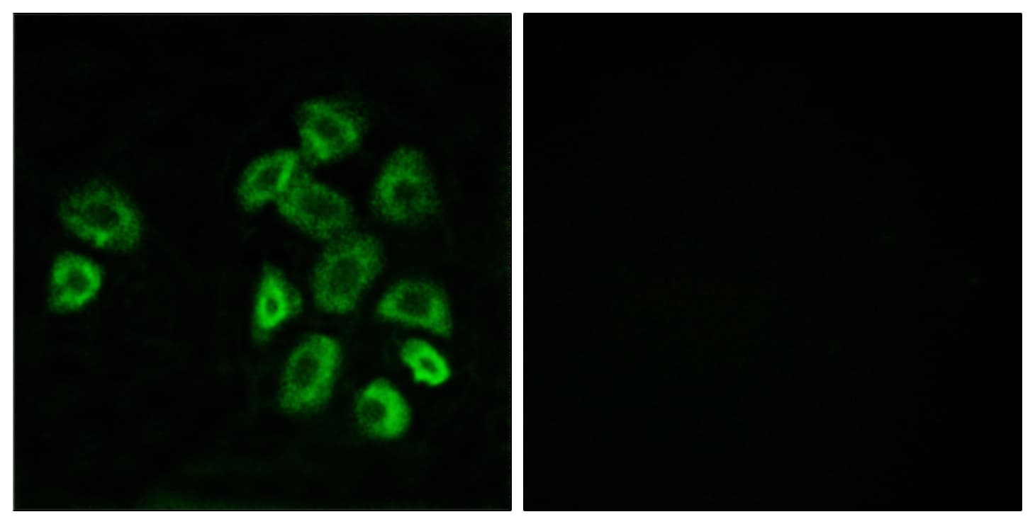 Polyclonal Rabbit anti-Human RAIG2 / GPRC5B Antibody (aa61-110, IF, WB)