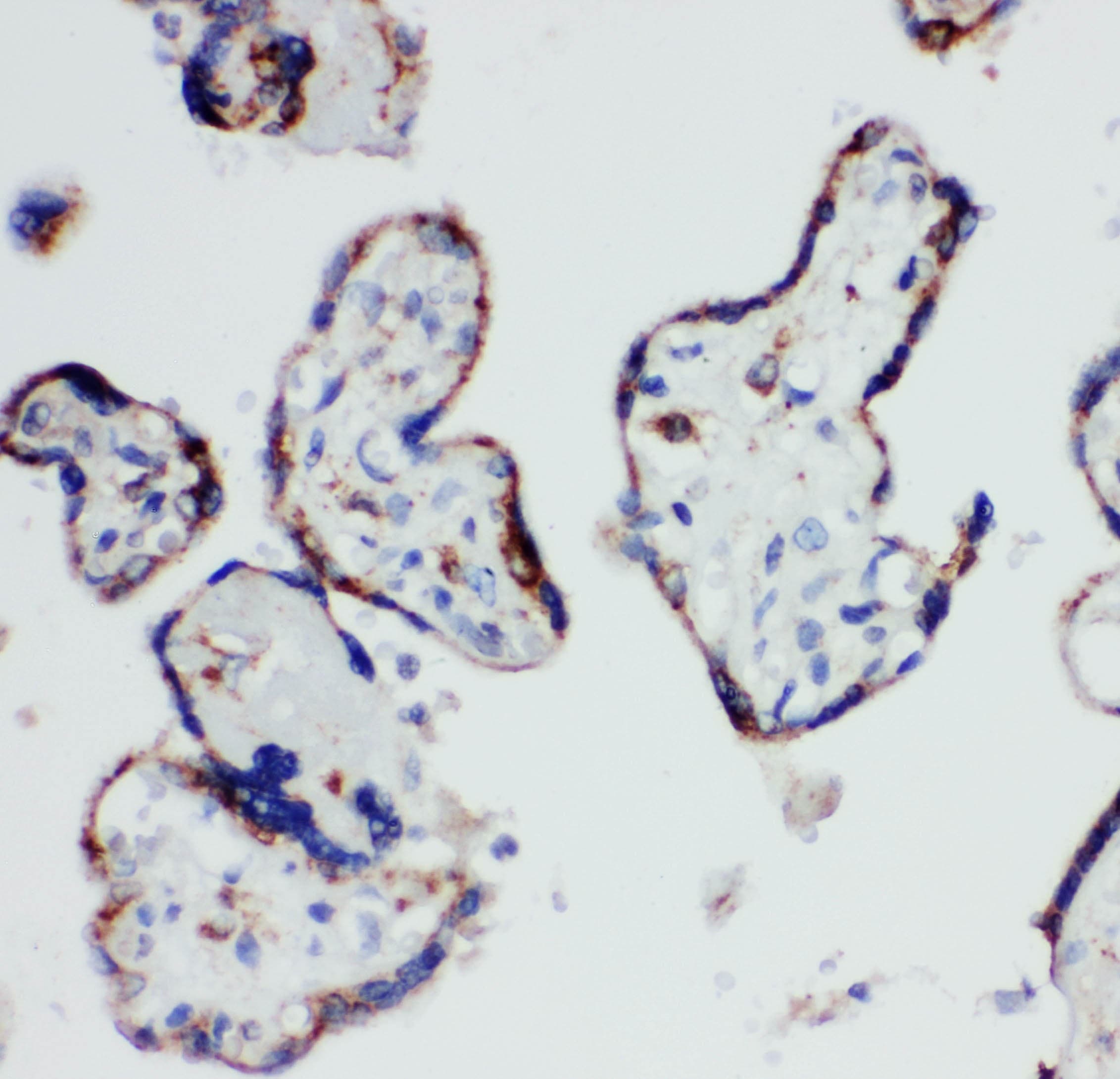Polyclonal Rabbit anti-Human HSD17 / HSD17B1 Antibody (aa29-43, IHC, WB)