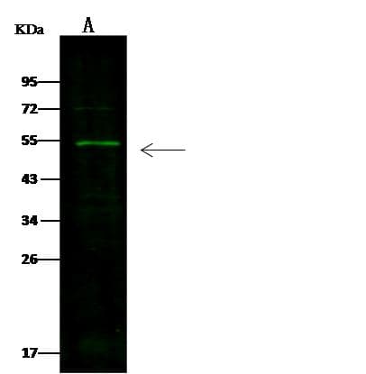 Polyclonal Rabbit anti-Human SMAD5 Antibody (Preservative Free, IHC, IF, WB)