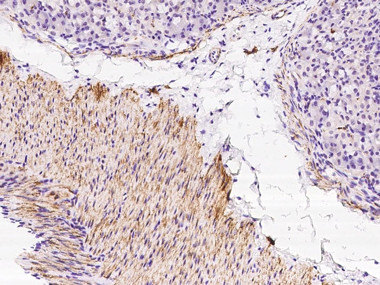 DES / Desmin Antibody (Preservative Free)