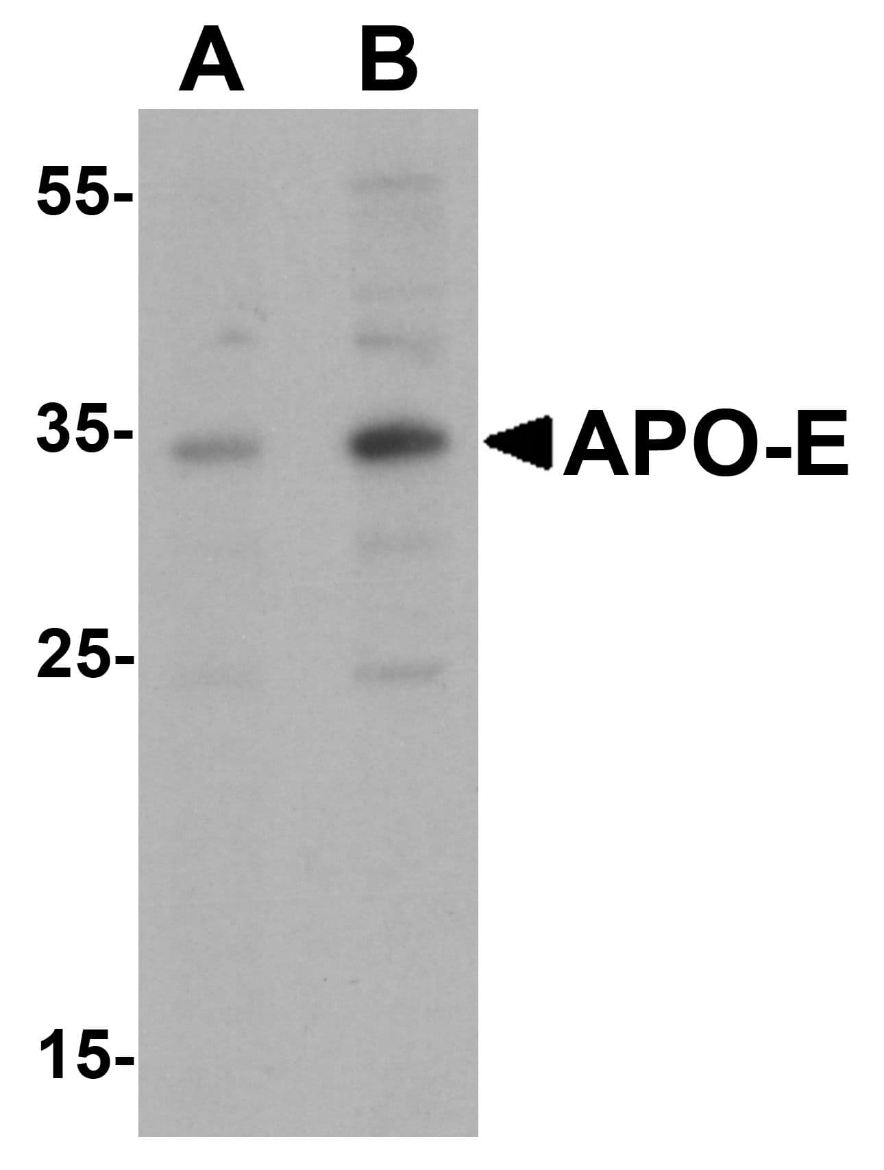 PathPlus™ APOE / Apolipoprotein E Antibody