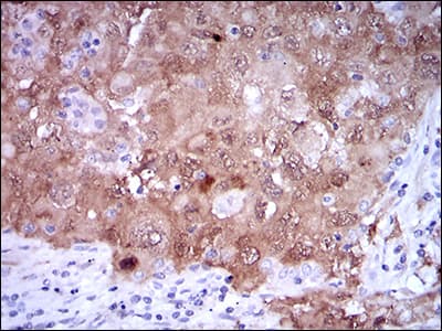 Monoclonal Mouse anti-Human p16INK4a / CDKN2A Antibody (clone 1D7D2, IHC, WB)