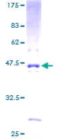 Human PCA1 / ALKBH3 Protein (Recombinant GST)