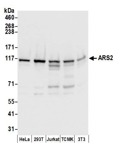 SRRT / ARS2 Antibody (aa826-876)