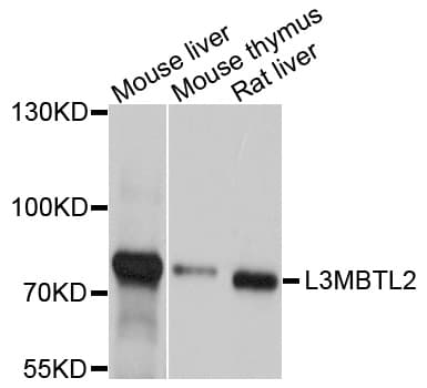 Polyclonal Rabbit anti-Human L3MBTL2 Antibody (WB)