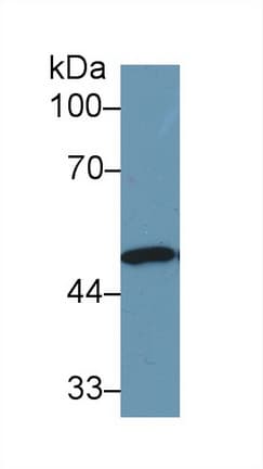 ENO1 / Alpha Enolase Antibody (APC)