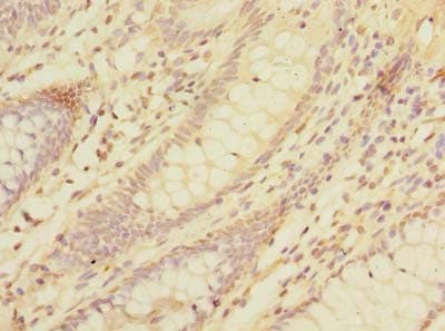 Polyclonal Rabbit anti-Human DAT1 / LMO3 Antibody (IHC, WB)