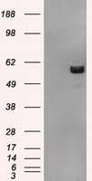 ATP5B / ATP Synthase Beta Antibody (clone OTI3H8)